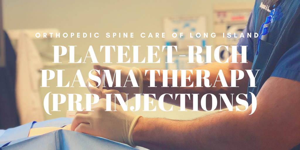 A photo of platelet rich plasma therapy.
